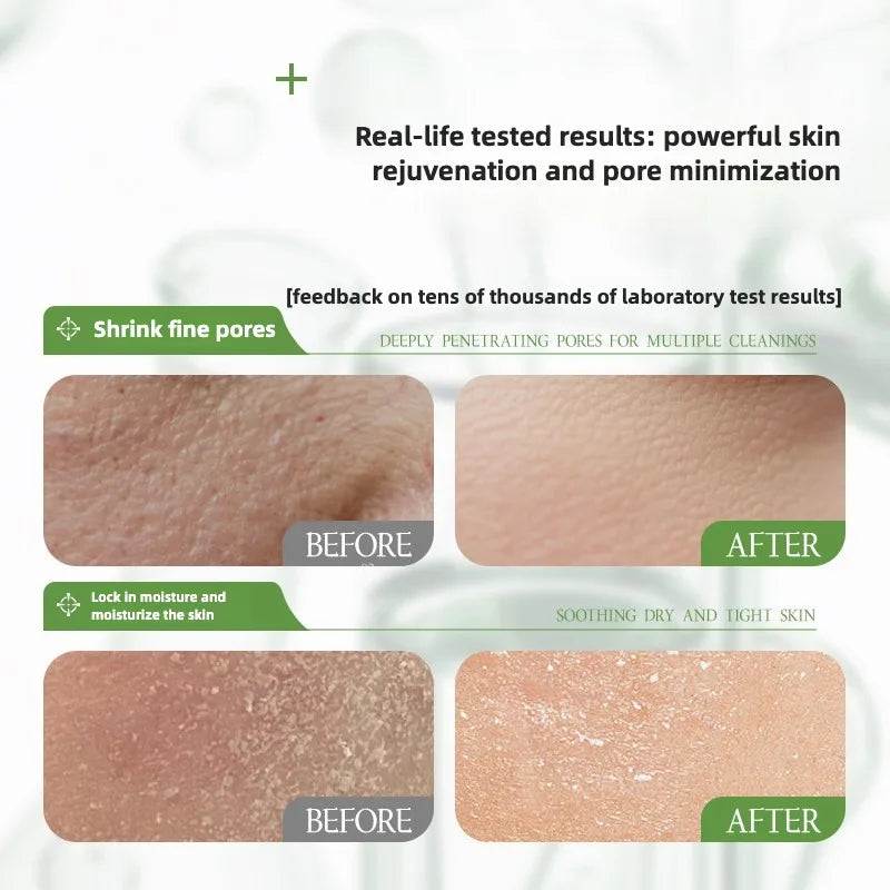 100ml Rosemary Hydrosol Anti- Wrinkle Serum- Fade Fine Lines Facial Moisturizing & Brightening Anti Aging Firming Skin Care-Unisex