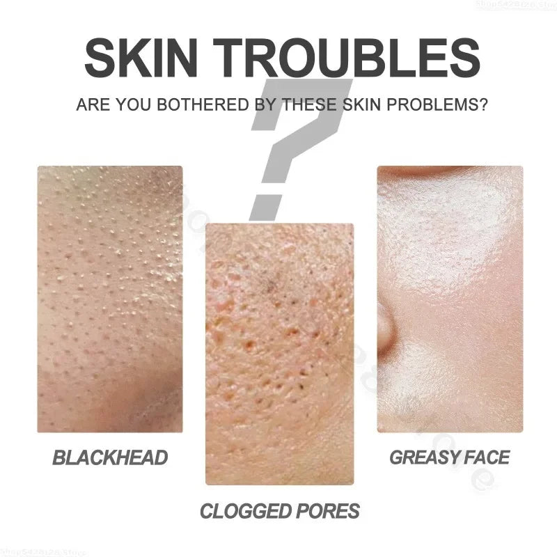 Zsea Facial Cleanser- Men's Deep Cleansing Oil Control Cleanser, Moisturizing, Cleansing, and Shrinks Pores Facial Skin Care